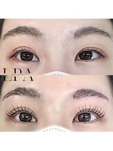 レピア 郡山駅前店/韓国式LEPIA Before&After