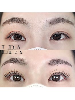 レピア 郡山駅前店/韓国式LEPIA Before&After