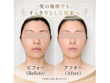 ブルーエ(bleuet)の雰囲気（一回でスッキリリフトアップ！オールハンドトリートメント♪）