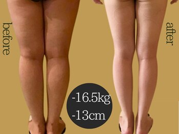 マルレ(MARLE)の写真/美脚計画!【脚集中♪インディバ痩身★90分11800】太ももの固いセル脂肪・凸凹も分解♪冷えやむくみも撃退！