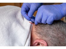 ライズ/お首のコリにはりが効きます。