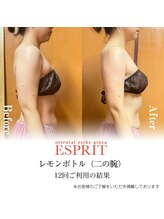 エスプリ 新宿店/レモンボトル×シェイプスリム