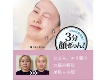 たるみがおこる原因の根本ケア