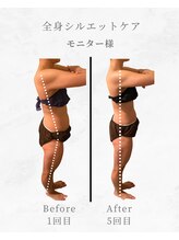 エテルナ バイ ハクビ(Eterna byHAKUBI)/全身シルエットケアモニター様