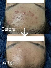 エステサロン ベルジュール/