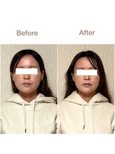 紡(TSUMUGU)/骨格補正スパ