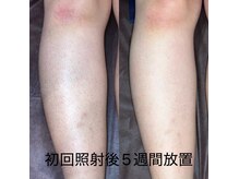 リオル(ReOlu)の雰囲気（お子様の成長や肌質に合わせて一人一人に最適な施術をご提案）