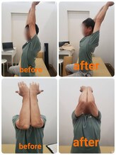 若松整体院若林区院/猫背矯正＆骨盤矯正☆