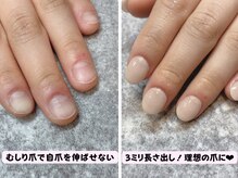 ココネイル(coco.nail)/コンプレックス爪を美爪にします