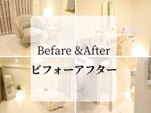 アメリイ 百合ヶ丘 新百合ヶ丘(Amerii)/痩身&肌管理&小顔のBefore After