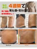 【運動ゼロ食事制限なし】メンズぽっこりお腹4週間4回集中コース￥35,200