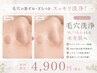 【毛穴悩み改善】毛穴洗浄×小顔ラジオ波(ヘッドスパ付)¥4,900