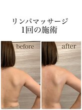 ビアージュ ナガクテ(Beage nagakute)/大人気！リンパマッサージ