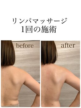 ビアージュ ナガクテ(Beage nagakute)/大人気！リンパマッサージ