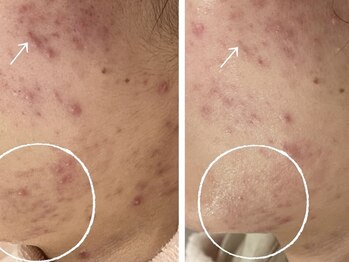 サロンヴェアリー 広尾(salon vary)/繰り返すトラブルを根本から解決