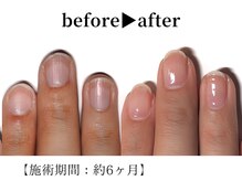 リング ザ ベル(ring the bell)/深爪・育爪専門コース