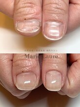 マリーロール 淀屋橋本店(Marie Laure)/自爪育成/深爪矯正/ネイルケア