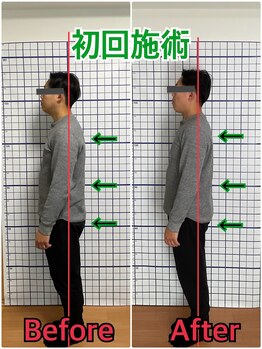 幸鍼灸整体院 武庫之荘院/整体・トレーニング・姿勢変化7