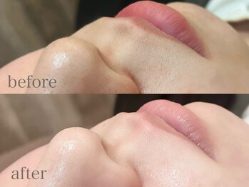 アイズ ラッシュブロウ(EYE'S lash_brows)/フェイシャルWax