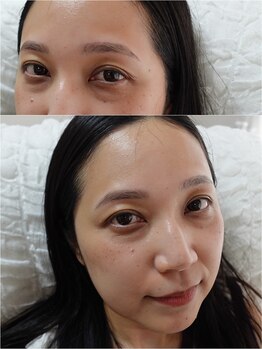 シェアリー(sharely..)/◆自分に似合う眉毛に