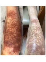 ピオニー(peony)/