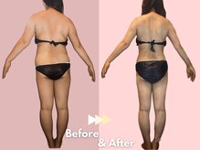 キレイサローネ 自由が丘店(KIREI SALONE)/☆ビフォーアフターのご紹介☆