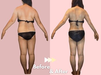 キレイサローネ 自由が丘店(KIREI SALONE)/☆ビフォーアフターのご紹介☆