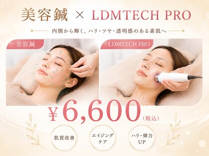 アンブル(Ambre)の写真