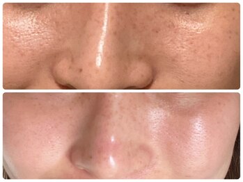 ジェミニ フェイス デザイン(Gemini Face Design)/REVI陶肌トリートメント