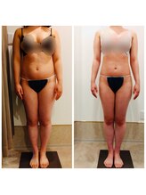 アイディエム 新宿店(IDM)/【モニター】160ｃｍ・20代