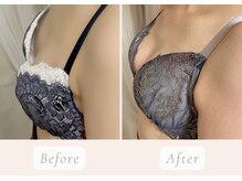 ノルン(Norn)/20代育乳バストケア（12回目）