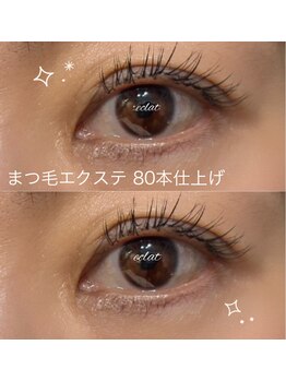 エクラ(eclat)/フラットラッシュ80本