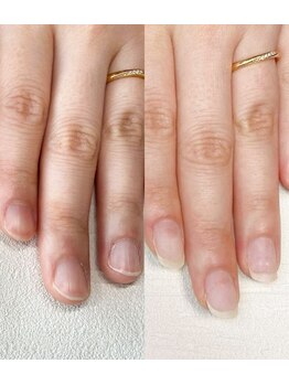 ポメロ(POMELO)/続けることでピンクの部分も育成