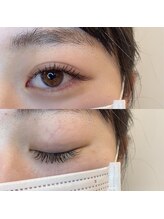 ウェヌス アイ ビューティ(VENUS eye beauty)/グードラッシュ100本