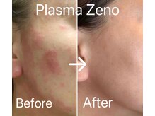 エステサロン ベルジュール/