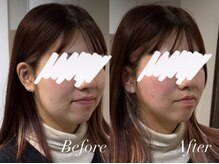 ハクト(Hakuto)/Before/After