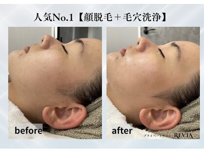 レビア(REVIA)の写真