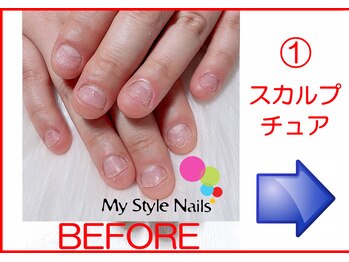 マイ スタイル ネイルズ(My Style Nails)/Before & After