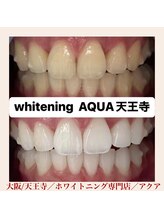 アクア 天王寺店(AQUA)/セルフホワイトニング/天王寺
