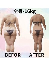 サロンド ヴィーナス 葛西店/本気痩せ★結果重視の充実ケア