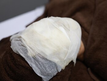 ヴィノ(VINNO)/施術イメージ　ハーブピーリング