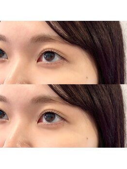 グロウ(Grow)/まつ毛パーマ【まつ毛/眉毛】