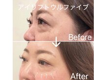 エステサロン ベルジュール/