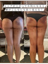 フェリーチェ(felice)/セル分解ビフォーアフター