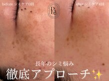 アールエーサロン 恵比寿 広尾(Ra salon)/継続ケアで理想のお肌に◎