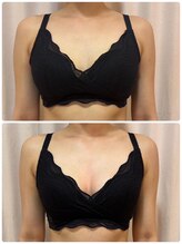 レイビス 仙台店(RAYVIS)/ふわふわマシュマロバスト2