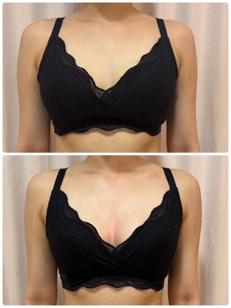 レイビス 仙台店(RAYVIS)/ふわふわマシュマロバスト2