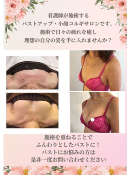アール(R)/バストケア