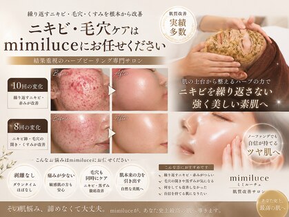 ミミルーチェ 中目黒(mimiluce)の写真