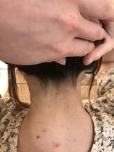 ナノハナ/鹿沼市本格全身脱毛ナノハナ